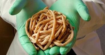 parazity extrahované z ľudského tela
