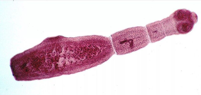 Echinokok je jedným z najnebezpečnejších parazitov pre človeka