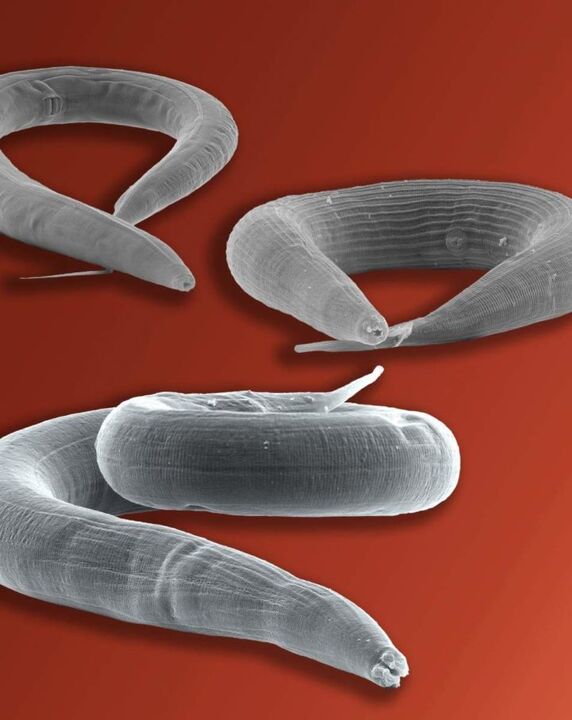 parazit pinworm žijúci v čreve
