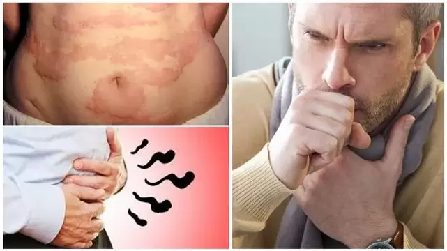 Alergie, kašeľ a nadúvanie sú príznakmi poškodenia tela červami