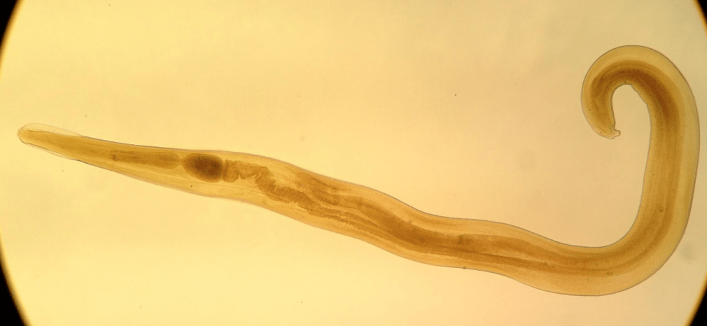 Pinworm je bežný parazit medzi deťmi. 